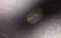 Aufgenommenes Bild mit einem Endoskop