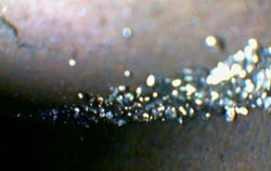 Imagen observada con el endoscopio