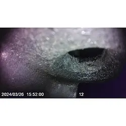Vídeo endoscopio - Utilización