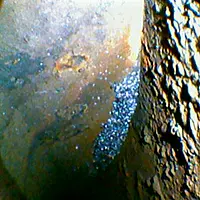 Endoscopio - Imagen de uso