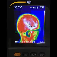 Ejemplo de uso de medidor de temperatura para fiebre