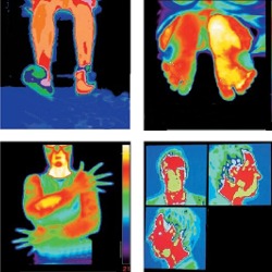 Imagen térmica con una cámara termográfica.