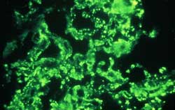 Imagem vista com um microscópio de fluorescência