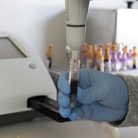 Elektronik Pipet Uygulama resmi